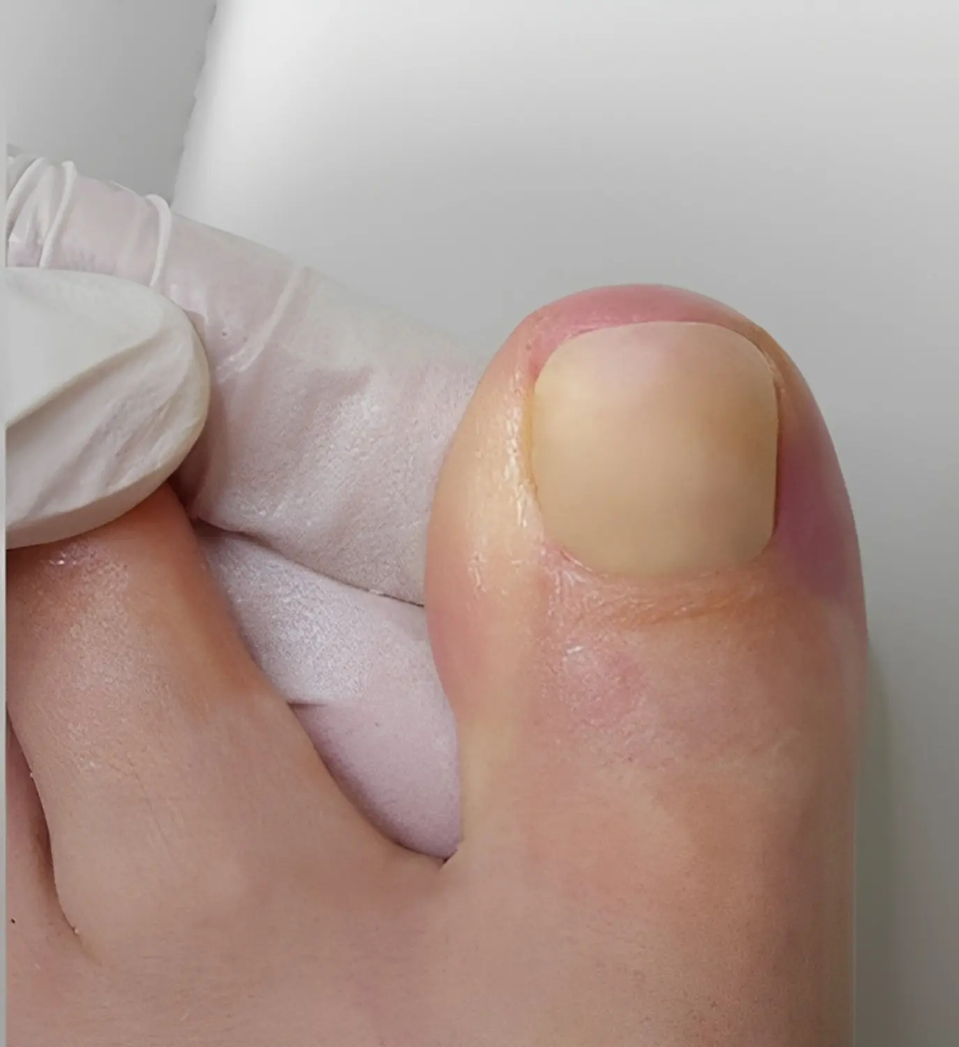 Beauty-Residenz Paderborn Nagelmasse pro Nagel