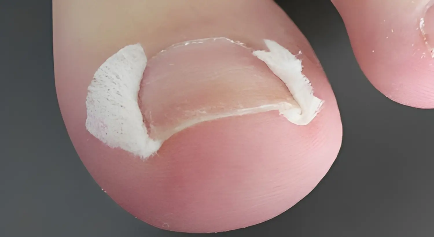 Beauty-Residenz Paderborn Tamponade